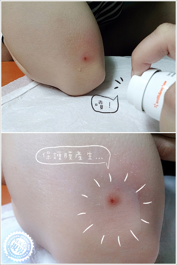 英商史耐輝-液態防水OK繃 (6).jpg 英商史耐輝-液態防水OK繃 (6).jpg