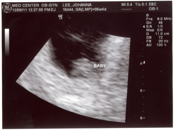 12-09-2011 6 weeks.jpg 12-09-2011 6 weeks.jpg