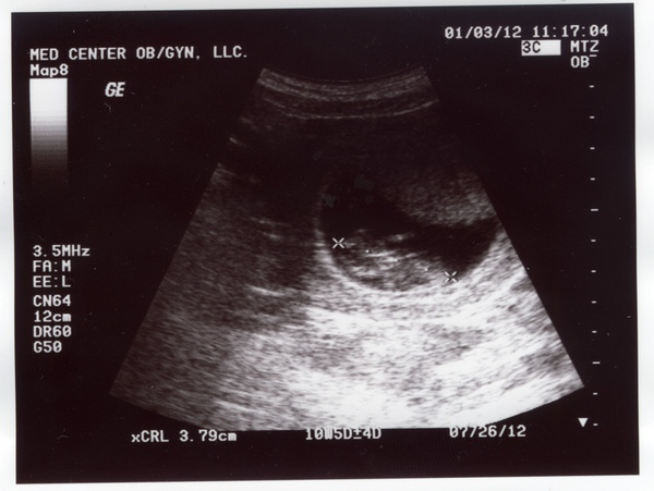 10 wks 1-3-2012.jpg 10 wks 1-3-2012.jpg
