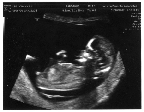 12 wks-1.jpg 12 wks-1.jpg