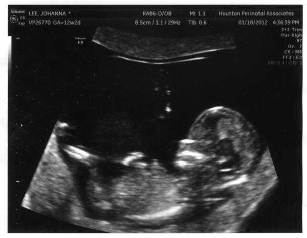 12 wks-3.jpg 12 wks-3.jpg