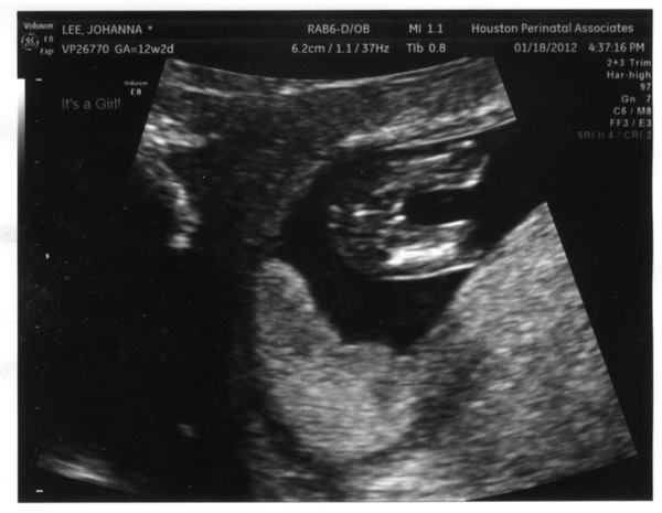 12 wks-4.jpg 12 wks-4.jpg