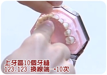 牙縫6.jpg 牙縫6.jpg