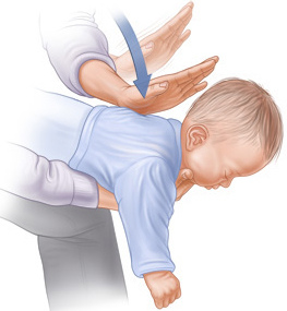 manovra_heimlich1-1.jpg manovra_heimlich1-1.jpg