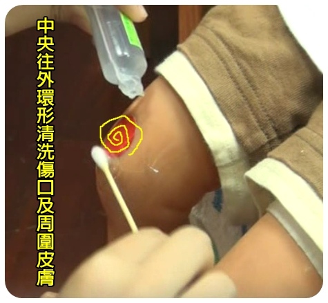 傷口5.jpg 傷口5.jpg