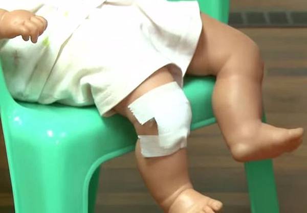 傷口.JPG 傷口.JPG