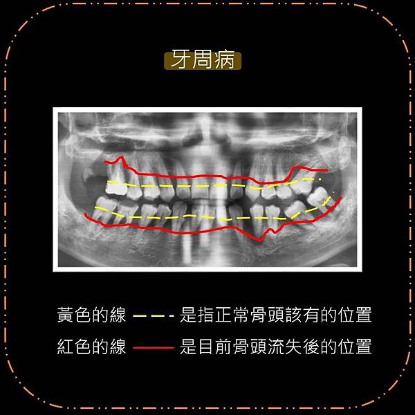 投影片1.JPG