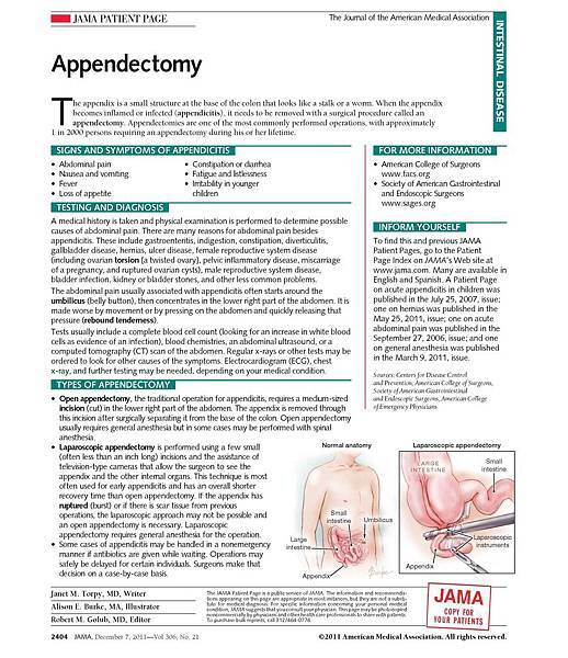 appendectomy