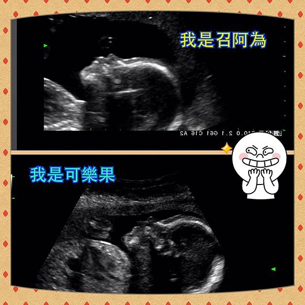 雙寶比較圖 雙寶比較圖