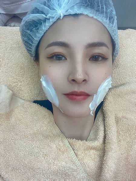 女人知己試用大隊,口碑行銷,部落客行銷,音波拉提,周彥吉醫師,芯悅皮膚科診所