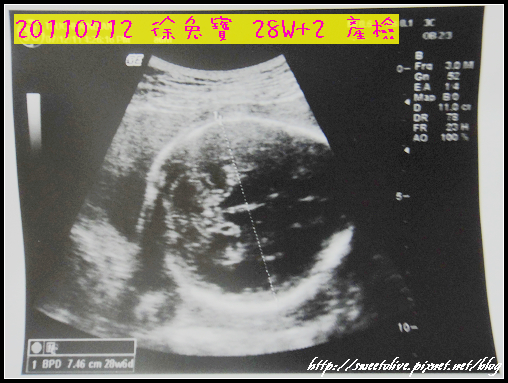 徐兔寶 28W 產檢-1.jpg 徐兔寶 28W 產檢-1.jpg