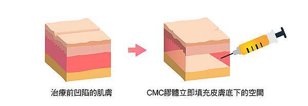 立即填充-01.jpg 立即填充-01.jpg