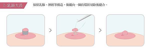 縮乳頭_乳頭太長-01.jpg