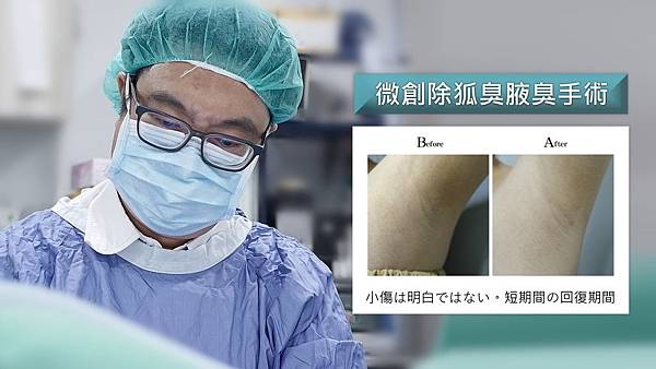 台中微創除狐臭手術PTT權威醫師推薦台中狐臭治療改善.jpg 台中微創除狐臭手術PTT權威醫師推薦台中狐臭治療改善.jpg