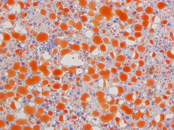 油紅O溶液 Oil Red O Solution中性脂質染色劑 Servicebio貨號G1015-100ML.png 油紅O溶液 Oil Red O Solution中性脂質染色劑 Servicebio貨號G1015-100ML.png