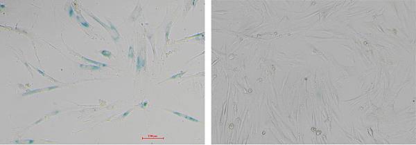 衰老細胞β-半乳糖苷酶染色試劑盒 Aging Cell β-galactosidase Staining Kit Servicebio貨號G1073-100T.jpg