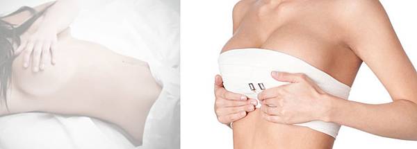 07隆乳手術後遺症風險副作用.jpg 07隆乳手術後遺症風險副作用.jpg
