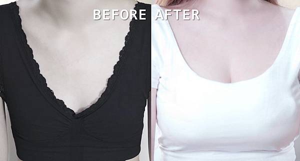 10隆乳手術ppt推薦醫師醫生介紹.jpg 10隆乳手術ppt推薦醫師醫生介紹.jpg