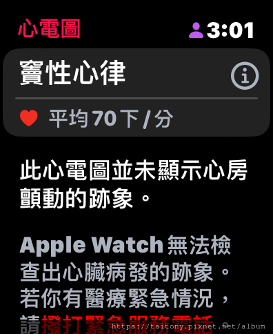 入手Apple Watch S8 8天後關於健康方面的體驗，