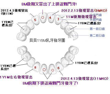 嬰幼兒牙齒排列圖(20顆)1Y8M