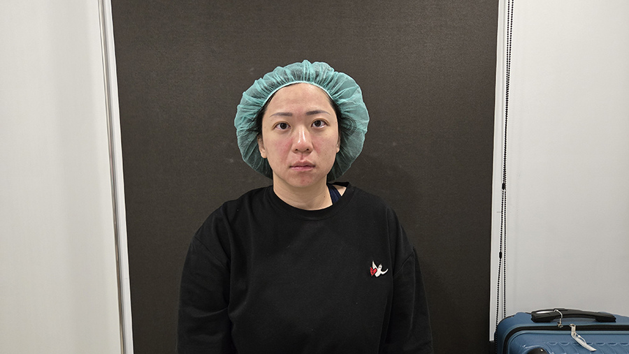 愛爾麗診所 全臉探索皮秒雷射 (1).jpg