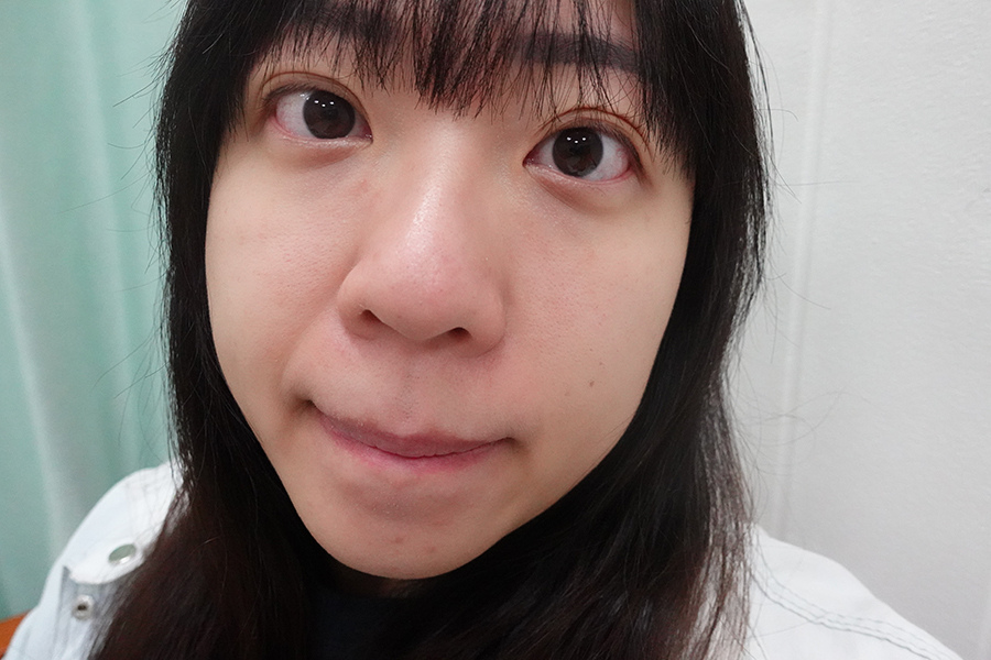 台北蜂巢皮秒診所分享 愛爾麗診所 ｜打造零毛孔細緻肌膚 我的