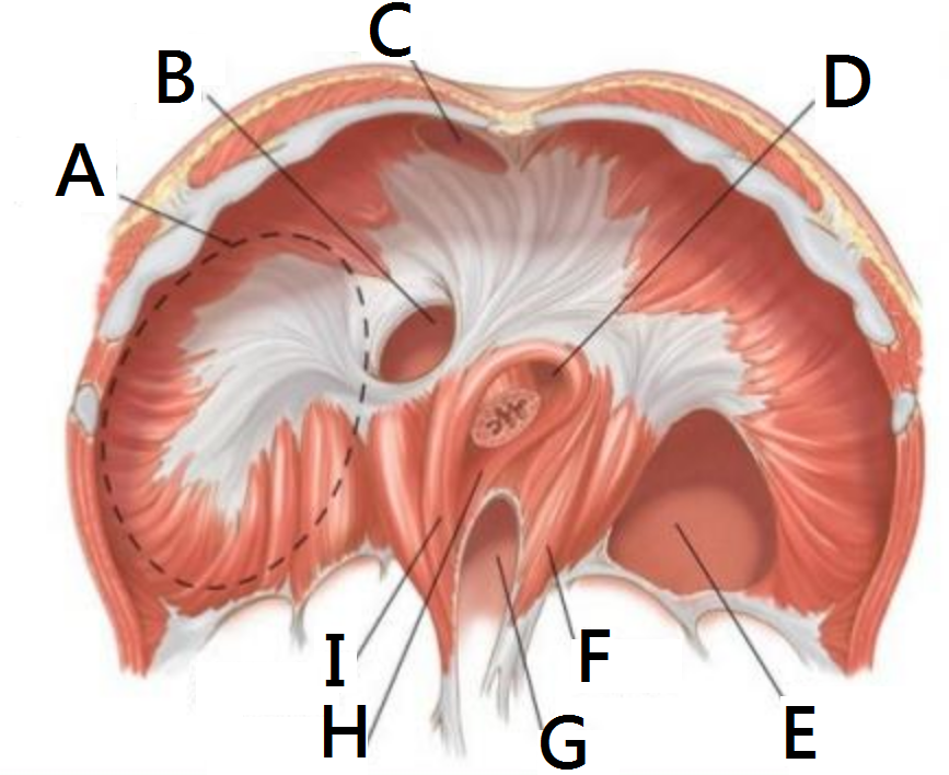 diaphragmatic_hernia.PNG