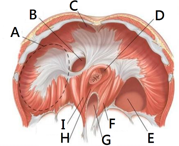 diaphragmatic_hernia.PNG