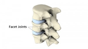 facet-joint-injection-300x169