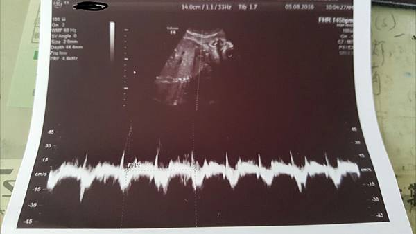 2016-08-05 14.08.35.jpg