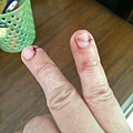 thumb