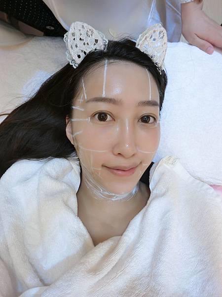 星和桃園_基因檢測+極線音波拉提15 星和桃園_基因檢測+極線音波拉提15