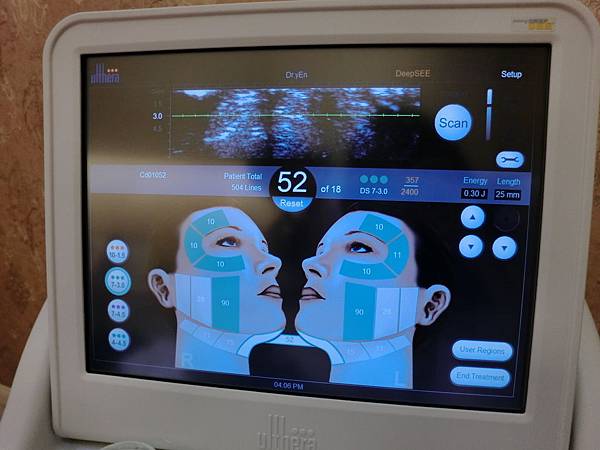 星和桃園_基因檢測+極線音波拉提16 星和桃園_基因檢測+極線音波拉提16