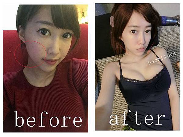 星和桃園_基因檢測+極線音波拉提01 星和桃園_基因檢測+極線音波拉提01