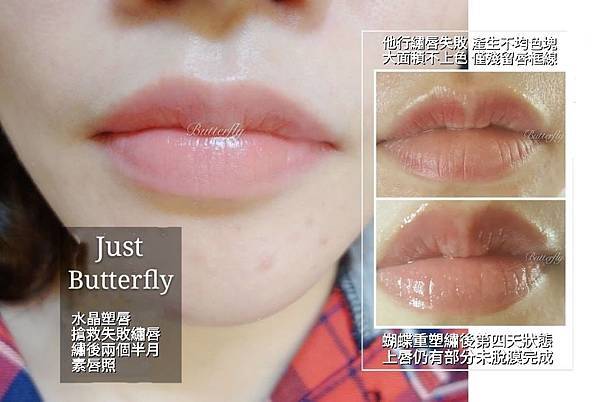 水晶塑唇 繡唇失敗重塑案例分享 蝴蝶國際紋繡美學高層次柔絲飄眉創始店 痞客邦