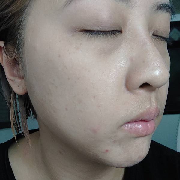 台灣積雪草純粹天然,專注養膚無負擔_KLOSER 積雪草修護 台灣積雪草純粹天然,專注養膚無負擔_KLOSER 積雪草修護