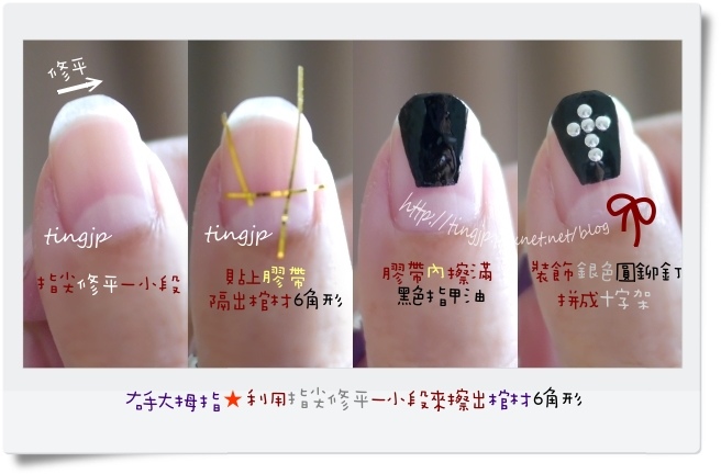 右手大拇指：十字棺材擦法