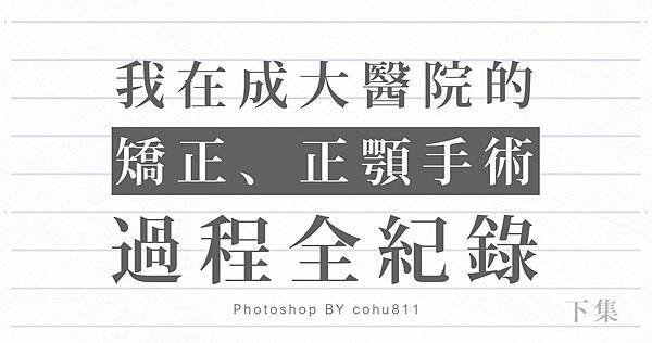 我在成大醫院的矯正、正顎手術過程全紀錄 下集 刊版