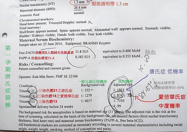 tn_唐氏 愛德華氏症 機率 20140715