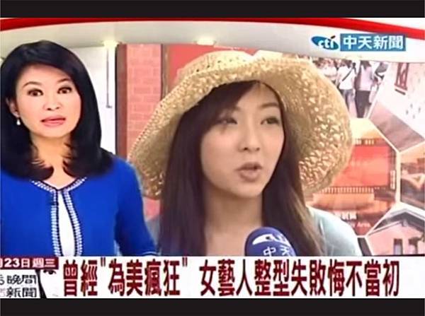 新聞 自體脂肪注射豐胸資生堂千金得 脂肪瘤 東京風采整型外科 張大力院長 痞客邦 新聞 自體脂肪注射豐胸資生堂千金得 脂肪瘤 東京風采整型外科 張大力院長 痞客邦