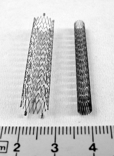 Stent4_fcm.jpg Stent4_fcm.jpg