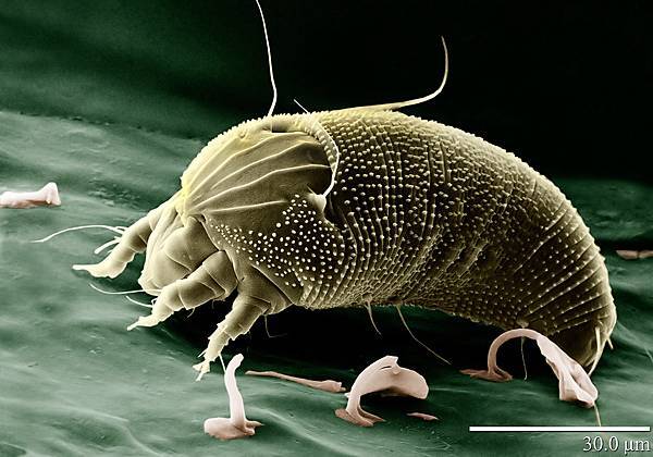 Rust_Mite,_Aceria_anthocoptes.jpg Rust_Mite,_Aceria_anthocoptes.jpg