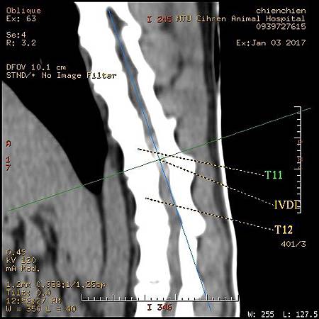 T11T12IVDD-2.jpg T11T12IVDD-2.jpg