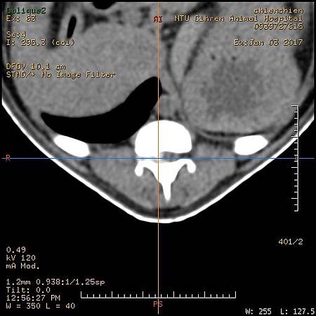 T11T12IVDD-1.jpg T11T12IVDD-1.jpg