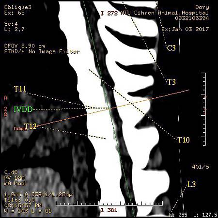 IVDDT10T11T12R-4.jpg IVDDT10T11T12R-4.jpg
