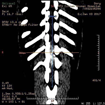 IVDDT10T11T12R-3.jpg IVDDT10T11T12R-3.jpg