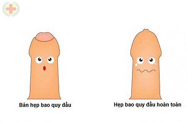tai-sao-bi-hep-bao-quy-dau.jpg