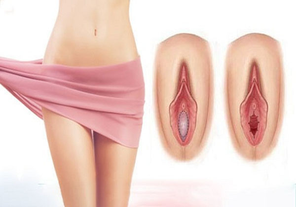 phong-kham-thu-hep-am-dao-o-vinh-phuc.jpg phong-kham-thu-hep-am-dao-o-vinh-phuc.jpg