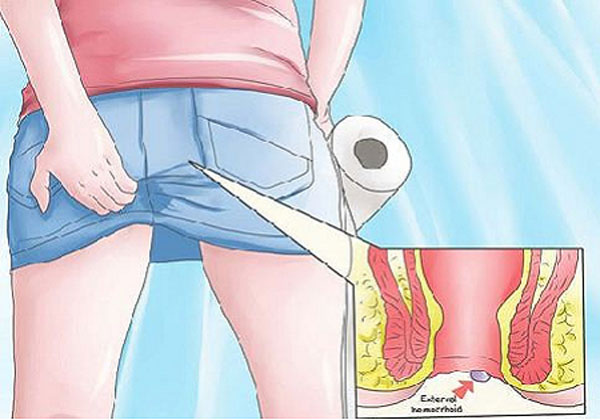 di-ia-ra-mau-mau-la-benh-gi.jpg di-ia-ra-mau-mau-la-benh-gi.jpg