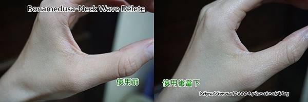 Bonamedusa-Neck Wave Delete-使用前後.jpg